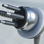 Shoulder Implant Model Shoulder Implant Model