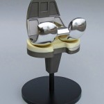 Medical Implant Model Knee Implant Model